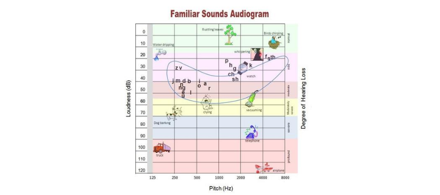 how to read an audiogram